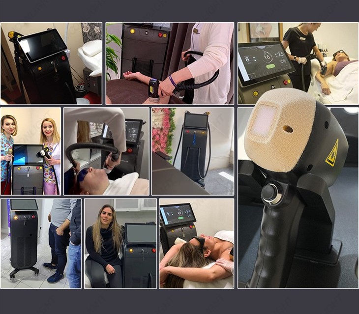 Large Spot Diode Laser Hair Removal